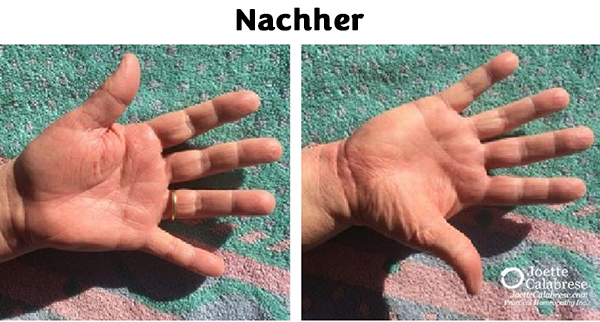 haende2_nachher.jpg