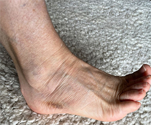 Zerrung, Verstauchung, Schmerz – ein Fall für Ruta 2