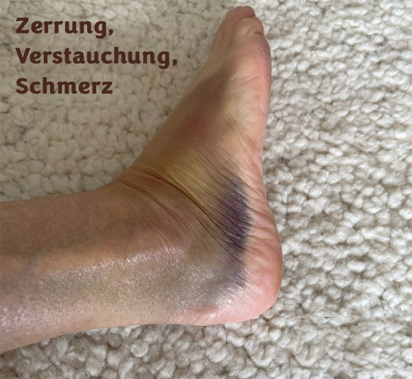 Zerrung, Verstauchung, Schmerz – ein Fall für Ruta