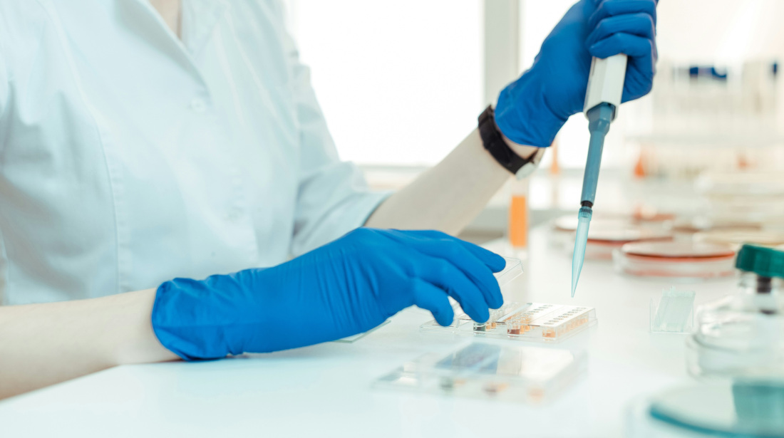 Person mit blauen Handschuhen und Pipette in der Hand, darunter verschiedene kleine Einfülllöcher