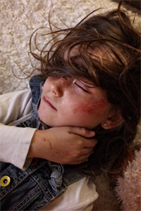 16_0519_beaten_little_girl_370311011_300x200.jpg
